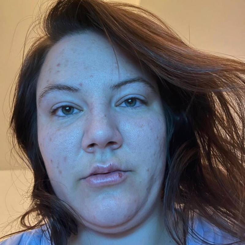 Melissa echo, 40, Arwal